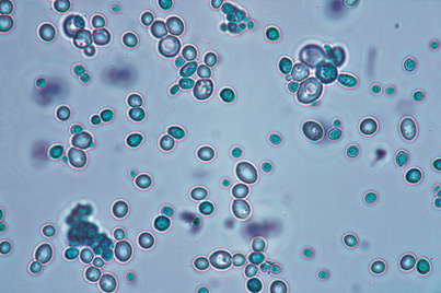 oenococcus